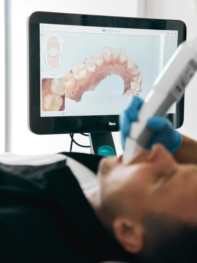 Skaner wewnątrzustny