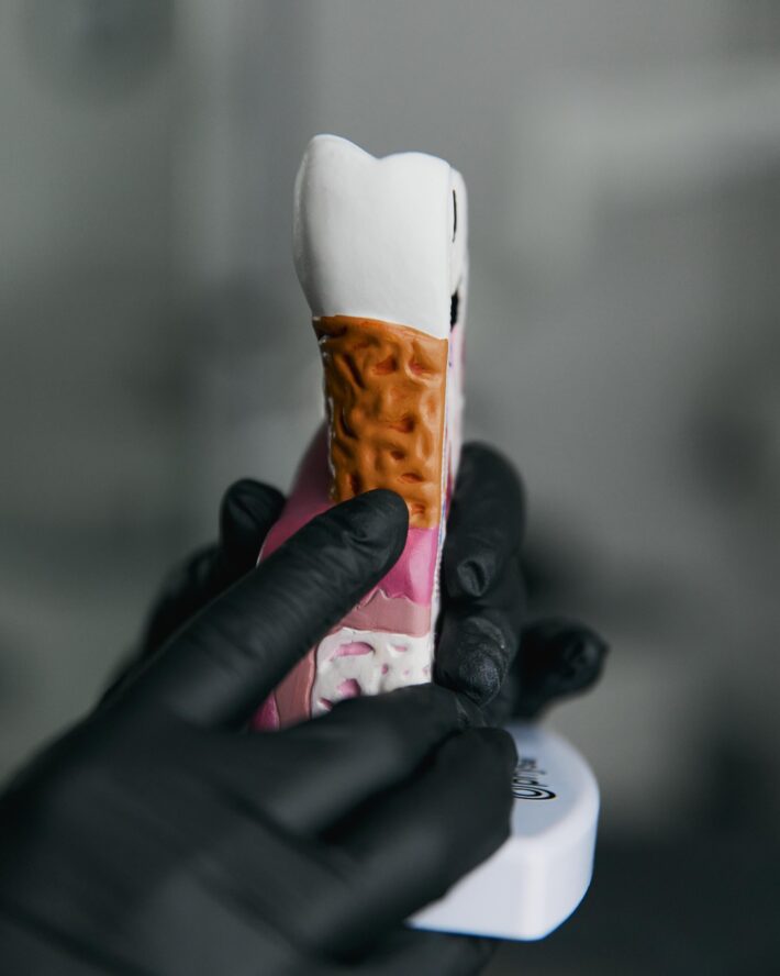 Zaniedbanie zdrowia jamy ustnej