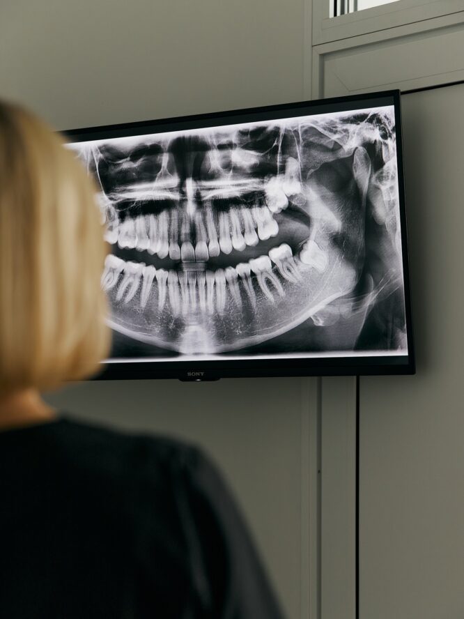 RTG zębów
