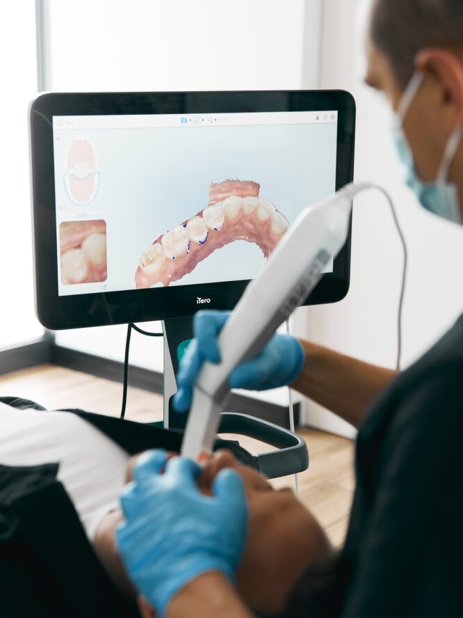 Skaner wewnątrzustny